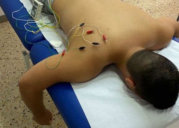 Neuromodulació Percutànea